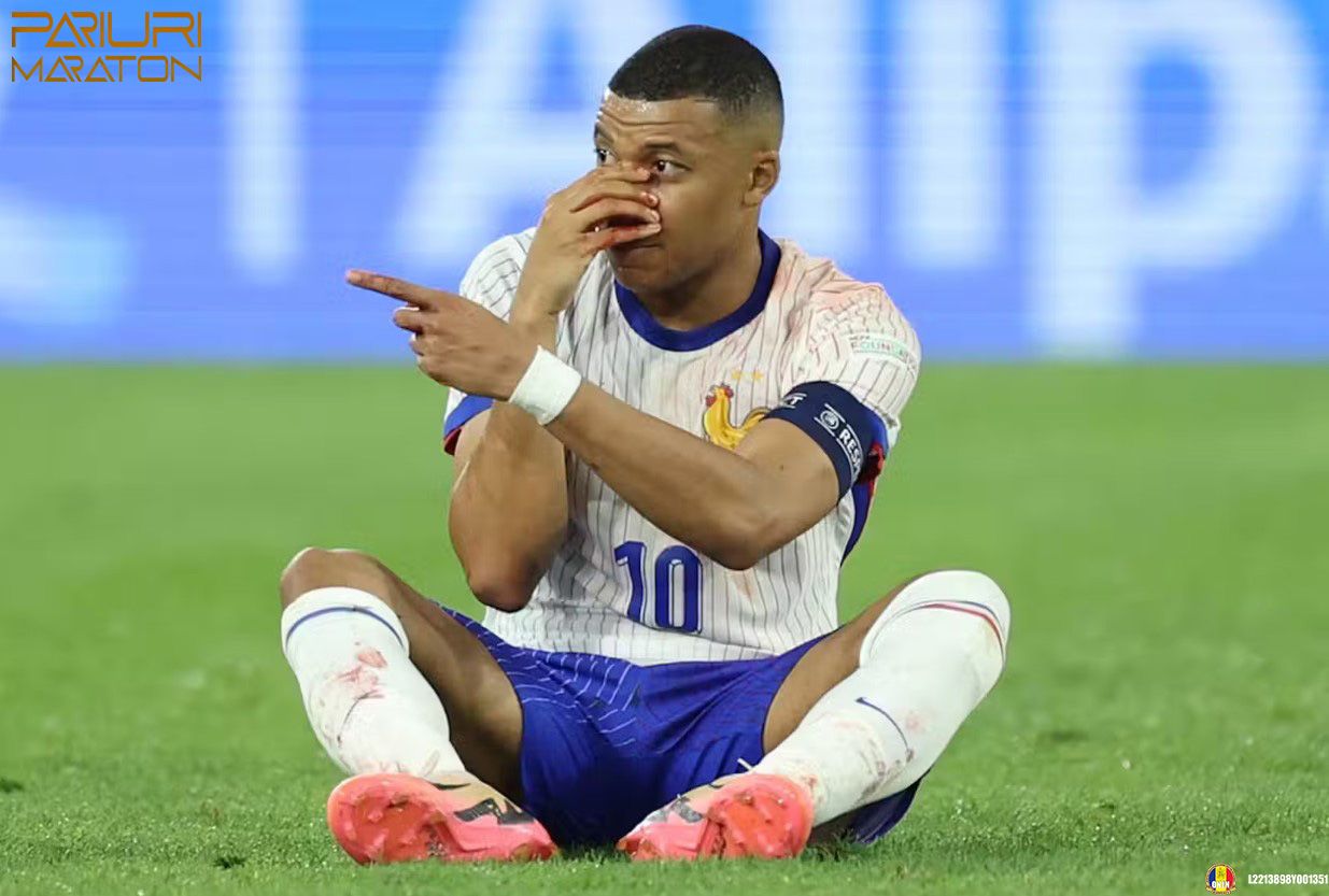 Mbappe Va Juca la Euro 2024 cu o Masca de Protectie